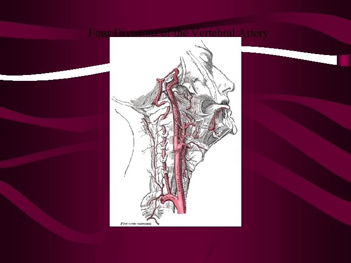 Four Divisions of the Vertebral Artery 