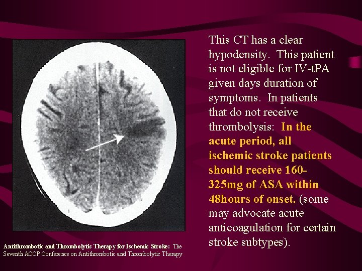 Antithrombotic and Thrombolytic Therapy for Ischemic Stroke: The Seventh ACCP Conference on Antithrombotic and