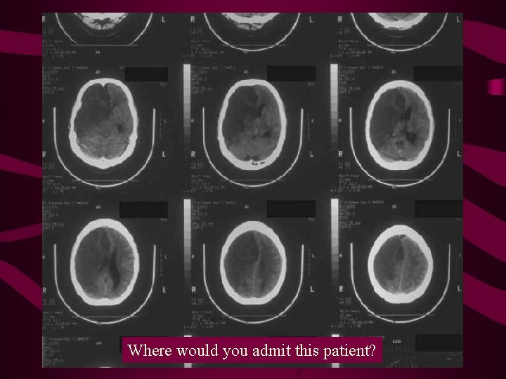 Where would you admit this patient? 