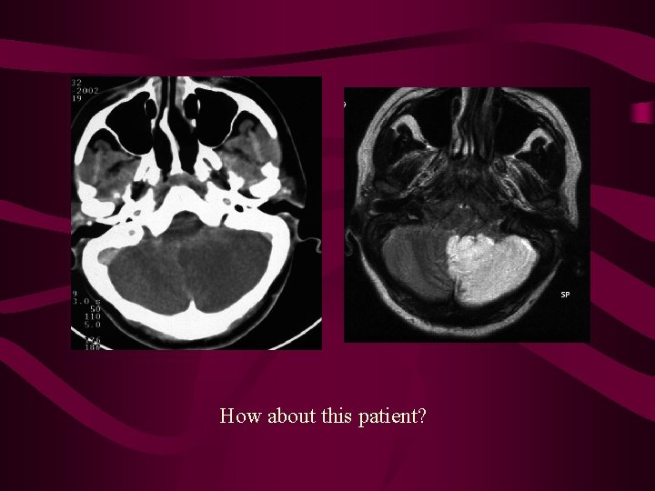 How about this patient? 