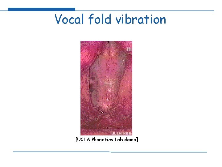 Vocal fold vibration [UCLA Phonetics Lab demo] 