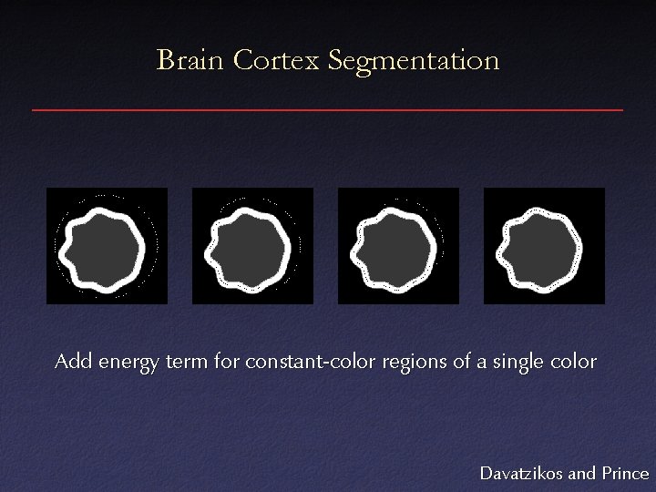 Brain Cortex Segmentation Add energy term for constant-color regions of a single color Davatzikos