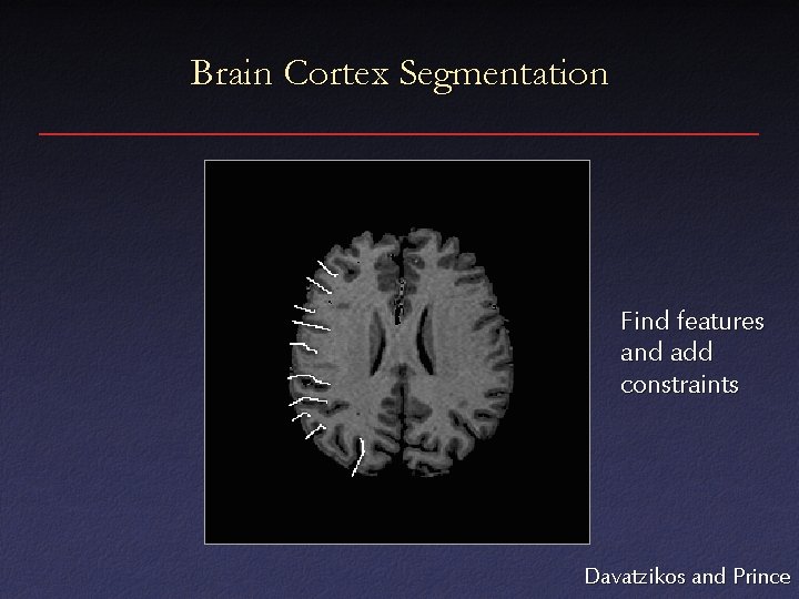 Brain Cortex Segmentation Find features and add constraints Davatzikos and Prince 