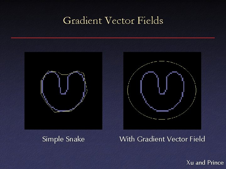 Gradient Vector Fields Simple Snake With Gradient Vector Field Xu and Prince 