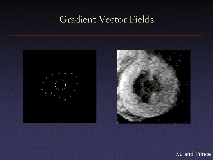 Gradient Vector Fields Xu and Prince 