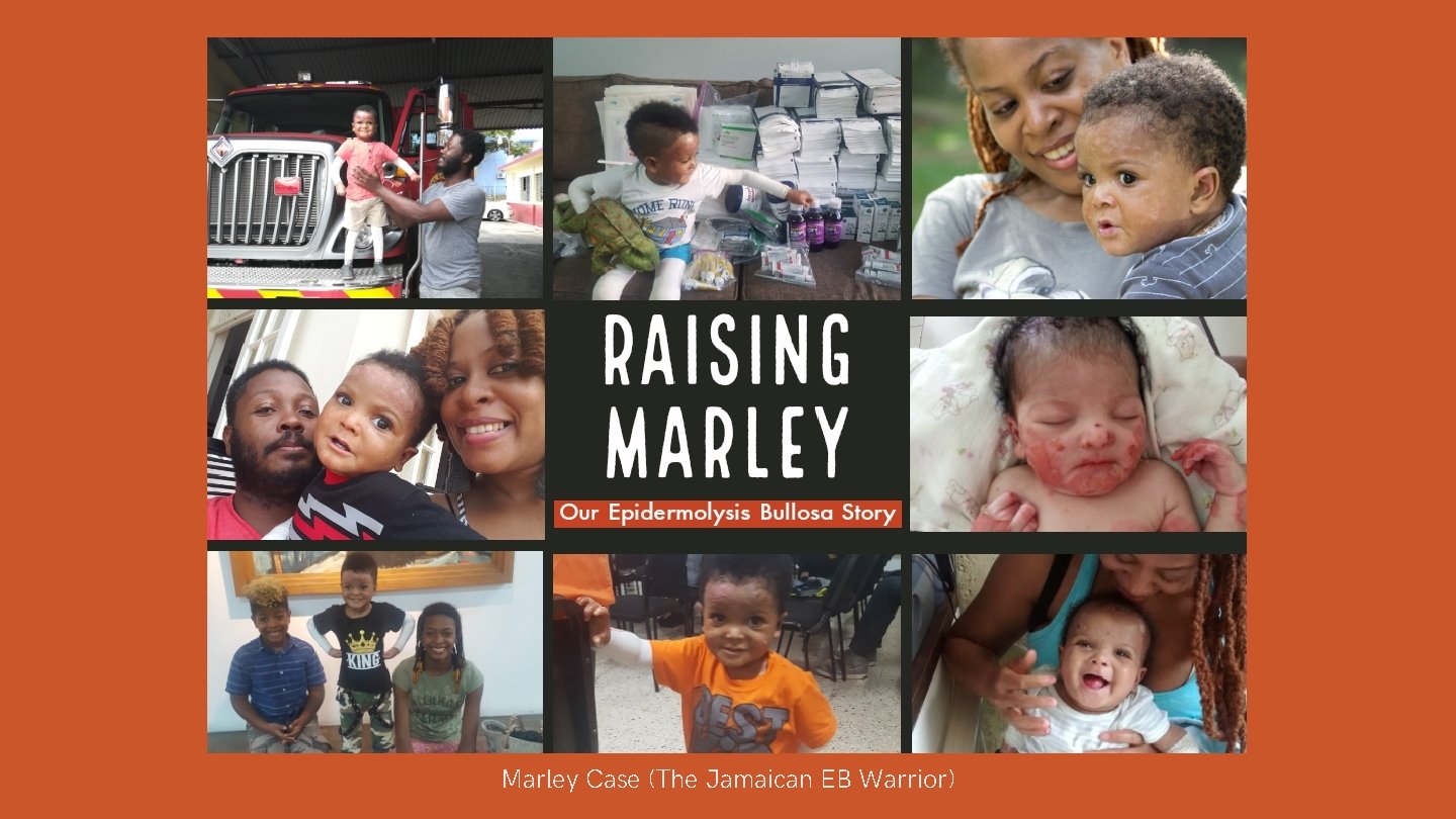 Marley Case (The Jamaican EB Warrior) 