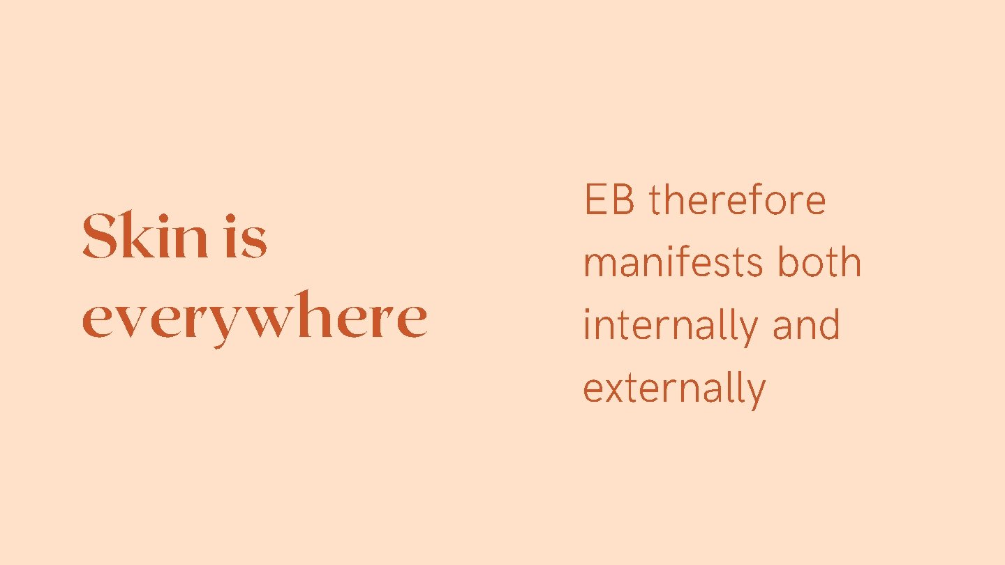 Skin is everywhere EB therefore manifests both internally and externally 