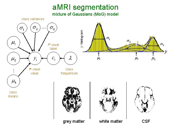 a. MRI segmentation mixture of Gaussians (Mo. G) model class variances … … ith