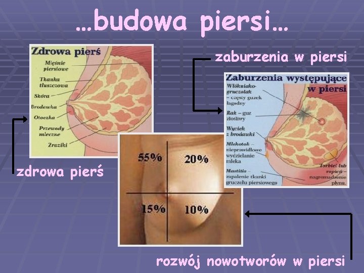 …budowa piersi… zaburzenia w piersi zdrowa pierś rozwój nowotworów w piersi 