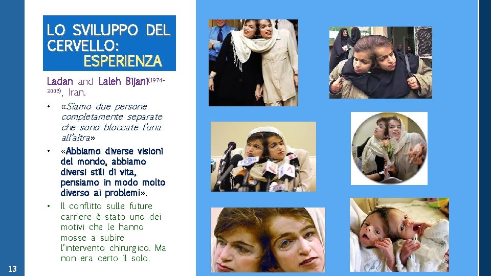 LO SVILUPPO DEL CERVELLO: ESPERIENZA Ladan and Laleh Bijani(1974– 2003), Iran. • «Siamo due