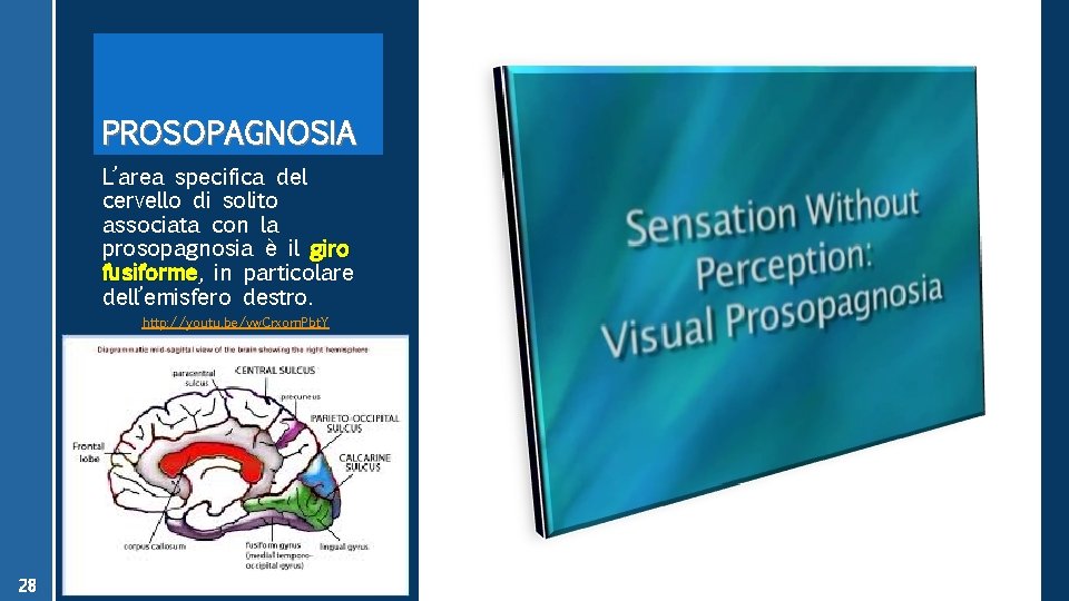 PROSOPAGNOSIA L’area specifica del cervello di solito associata con la prosopagnosia è il giro