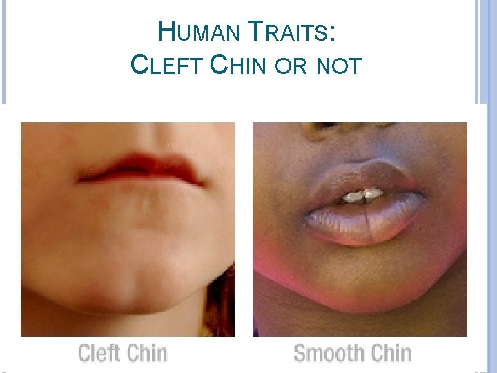 HUMAN TRAITS: CLEFT CHIN OR NOT 