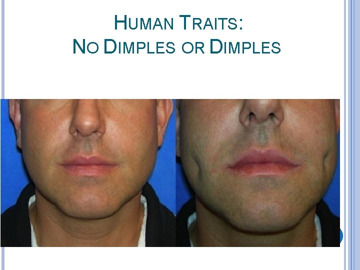 HUMAN TRAITS: NO DIMPLES OR DIMPLES 