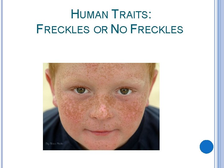 HUMAN TRAITS: FRECKLES OR NO FRECKLES 