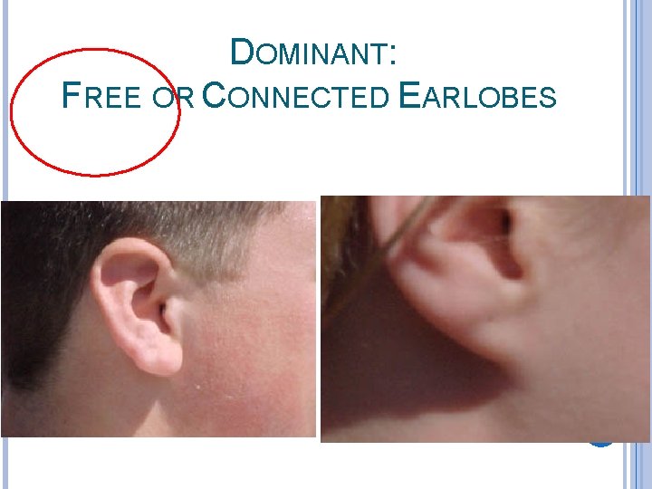 DOMINANT: FREE OR CONNECTED EARLOBES 