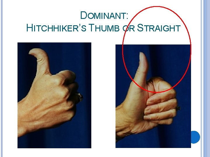 DOMINANT: HITCHHIKER’S THUMB OR STRAIGHT 