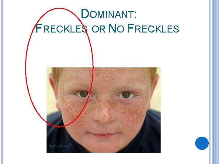 DOMINANT: FRECKLES OR NO FRECKLES 