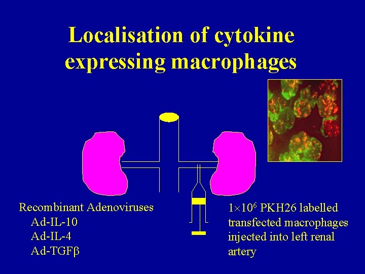 Localisation of cytokine expressing macrophages Recombinant Adenoviruses Ad-IL-10 Ad-IL-4 Ad-TGF 1 106 PKH 26