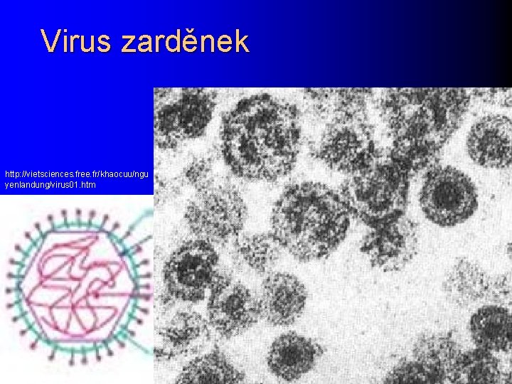 Virus zarděnek http: //vietsciences. free. fr/khaocuu/ngu yenlandung/virus 01. htm 