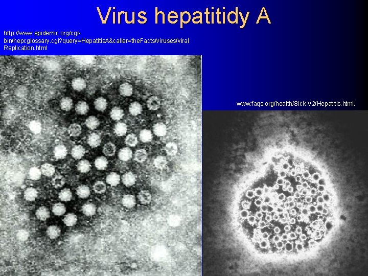 Virus hepatitidy A http: //www. epidemic. org/cgibin/hepcglossary. cgi? query=Hepatitis. A&caller=the. Facts/viruses/viral Replication. html www.