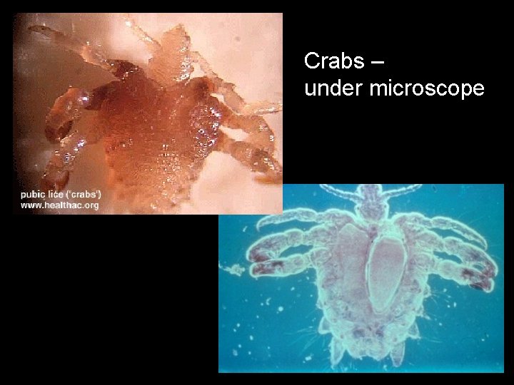 Crabs – under microscope 