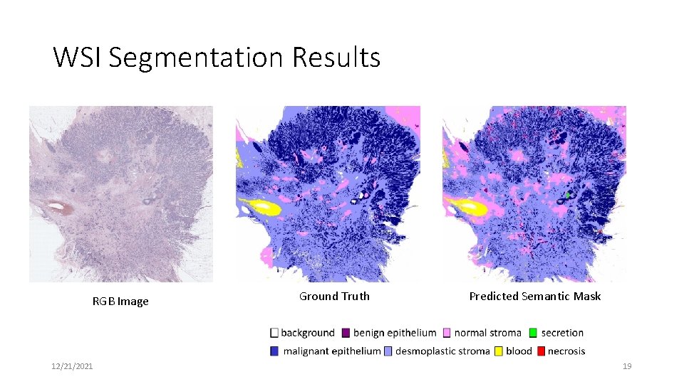 WSI Segmentation Results RGB Image 12/21/2021 Ground Truth Predicted Semantic Mask 19 WSI Segmentation Results RGB Image 12/21/2021 Ground Truth Predicted Semantic Mask 19