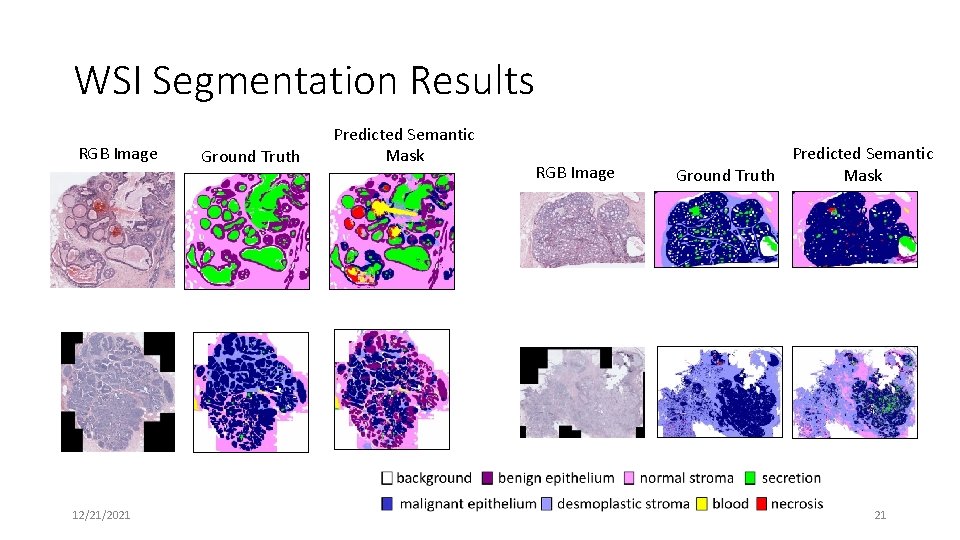 WSI Segmentation Results RGB Image 12/21/2021 Ground Truth Predicted Semantic Mask RGB Image Predicted WSI Segmentation Results RGB Image 12/21/2021 Ground Truth Predicted Semantic Mask RGB Image Predicted