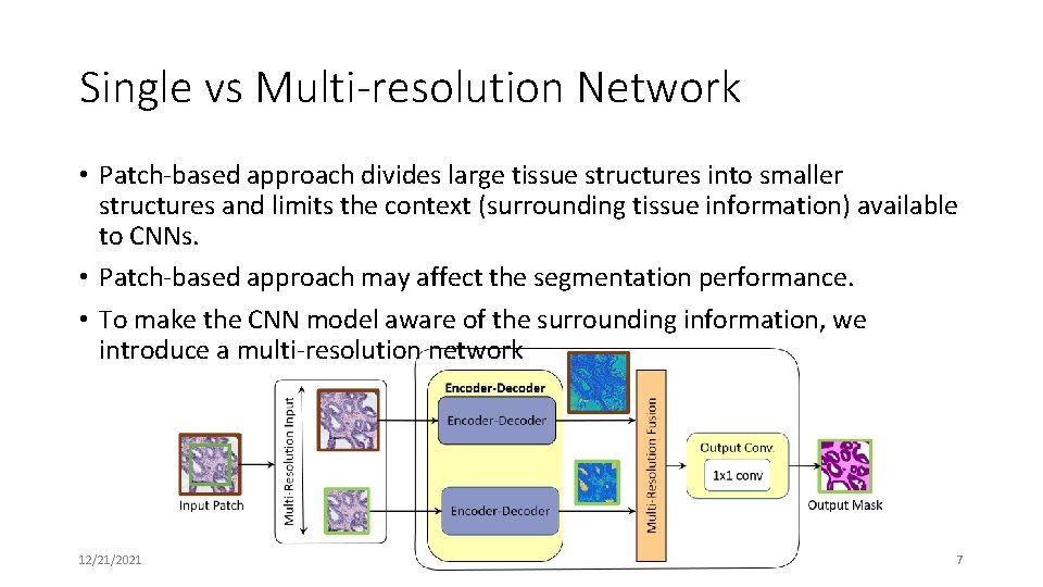 Single vs Multi-resolution Network • Patch-based approach divides large tissue structures into smaller structures Single vs Multi-resolution Network • Patch-based approach divides large tissue structures into smaller structures