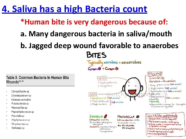 4. Saliva has a high Bacteria count *Human bite is very dangerous because of: