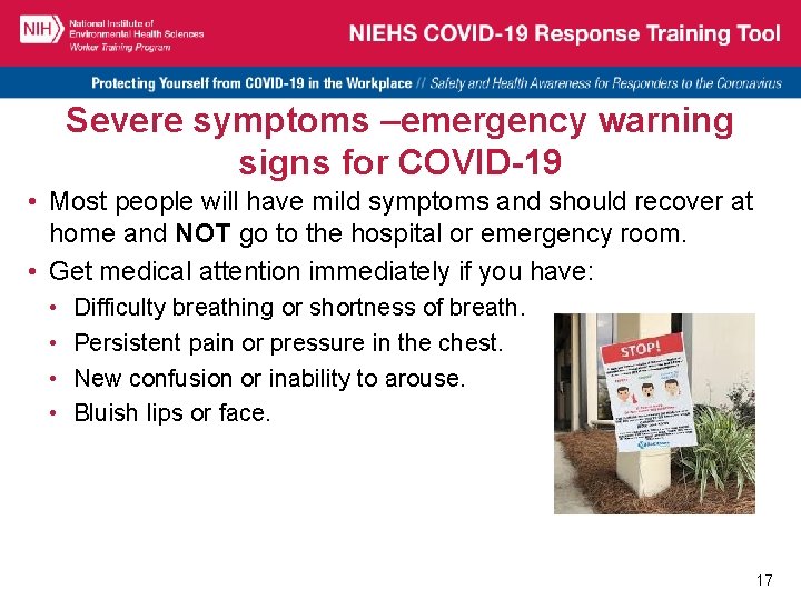Severe symptoms –emergency warning signs for COVID-19 • Most people will have mild symptoms