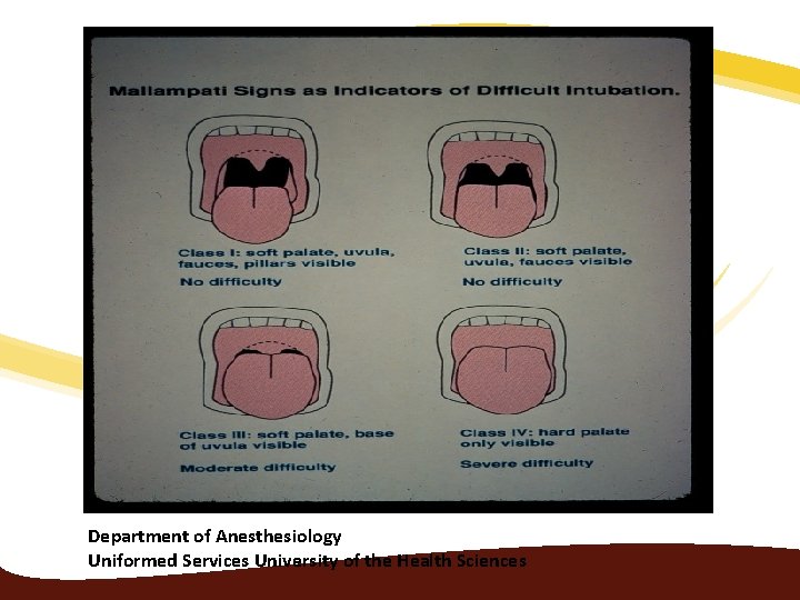 Department of Anesthesiology Uniformed Services University of the Health Sciences 