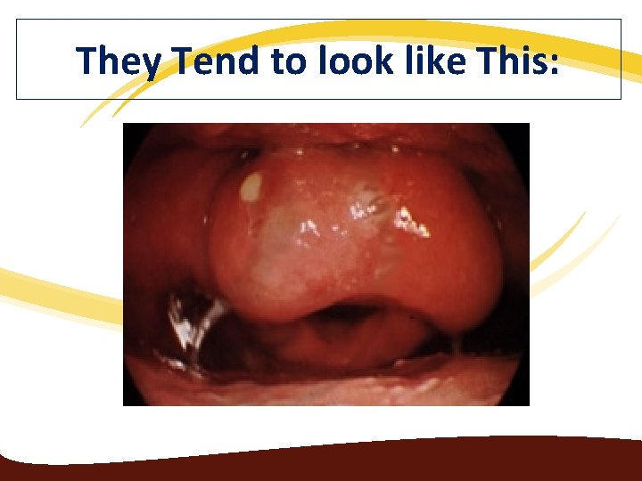 They Tend to look like This: 