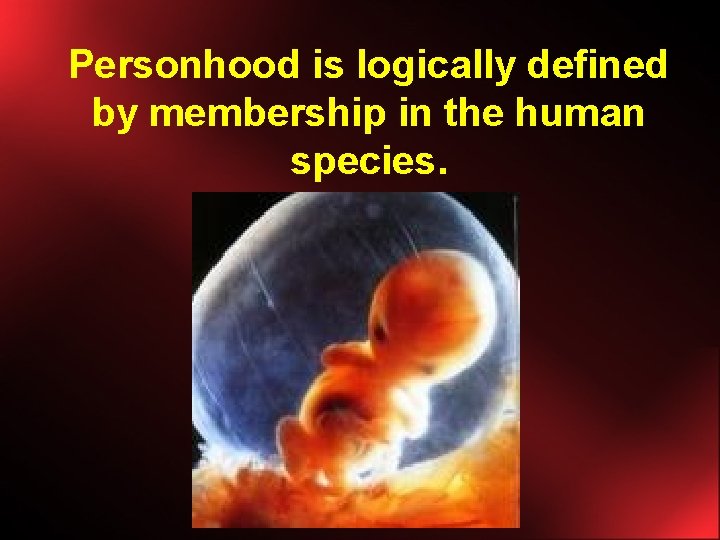Personhood is logically defined by membership in the human species. 