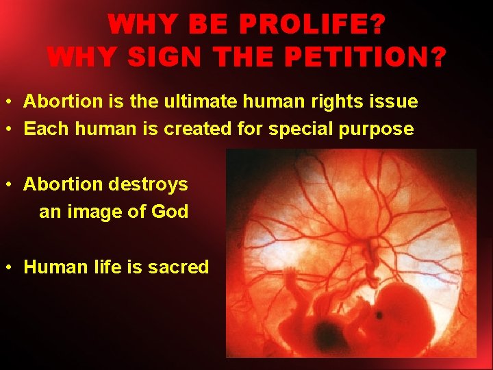 WHY BE PROLIFE? WHY SIGN THE PETITION? • Abortion is the ultimate human rights