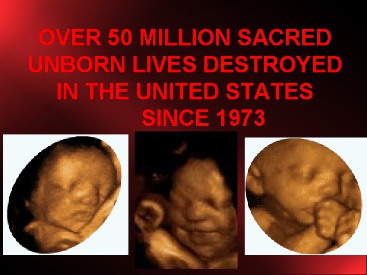 OVER 50 MILLION SACRED UNBORN LIVES DESTROYED IN THE UNITED STATES SINCE 1973 