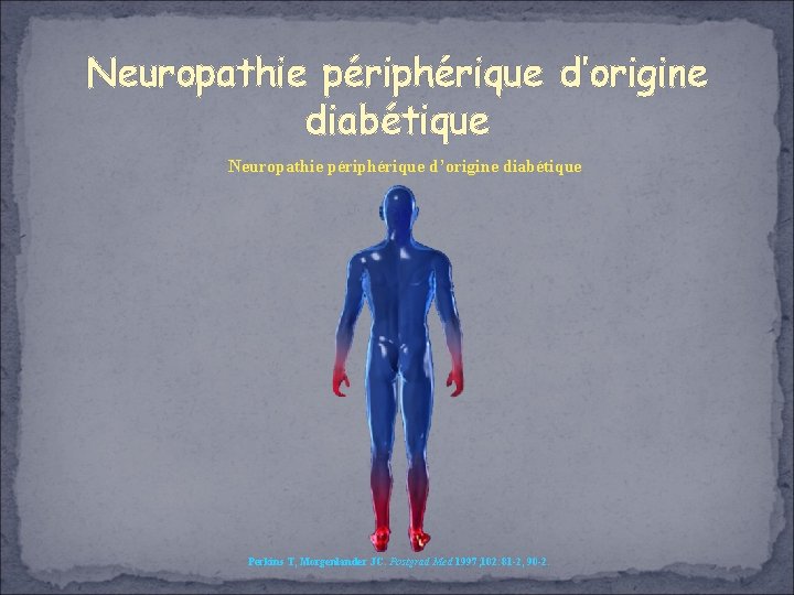 Neuropathie périphérique d’origine diabétique Perkins T, Morgenlander JC. Postgrad Med 1997; 102: 81 -2,