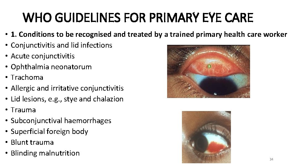 WHO GUIDELINES FOR PRIMARY EYE CARE • • • 1. Conditions to be recognised