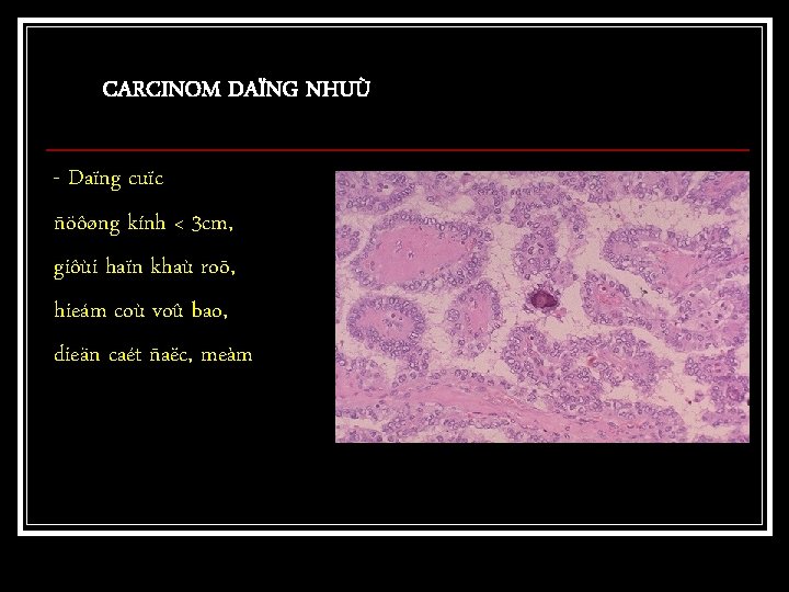 CARCINOM DAÏNG NHUÙ - Daïng cuïc ñöôøng kính < 3 cm, giôùi haïn khaù