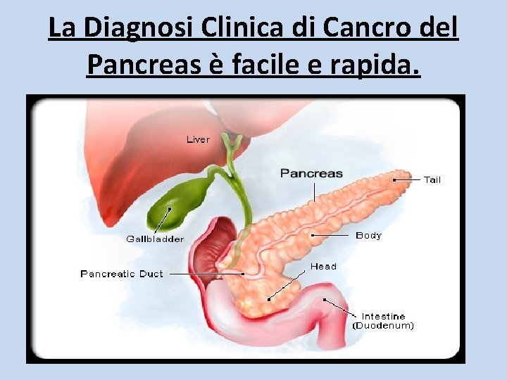 La Diagnosi Clinica di Cancro del Pancreas è facile e rapida. 