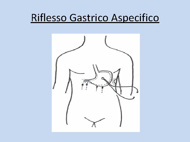 Riflesso Gastrico Aspecifico 