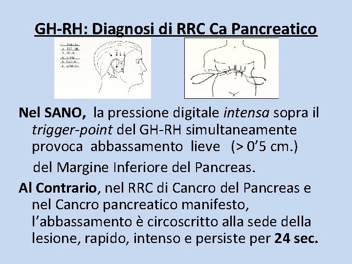 GH-RH: Diagnosi di RRC Ca Pancreatico Nel SANO, la pressione digitale intensa sopra il