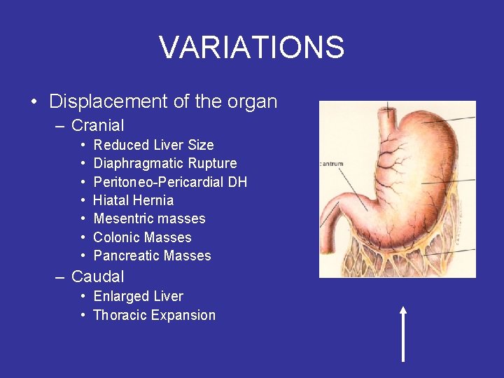 VARIATIONS • Displacement of the organ – Cranial • • Reduced Liver Size Diaphragmatic