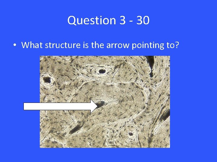 Question 3 - 30 • What structure is the arrow pointing to? 