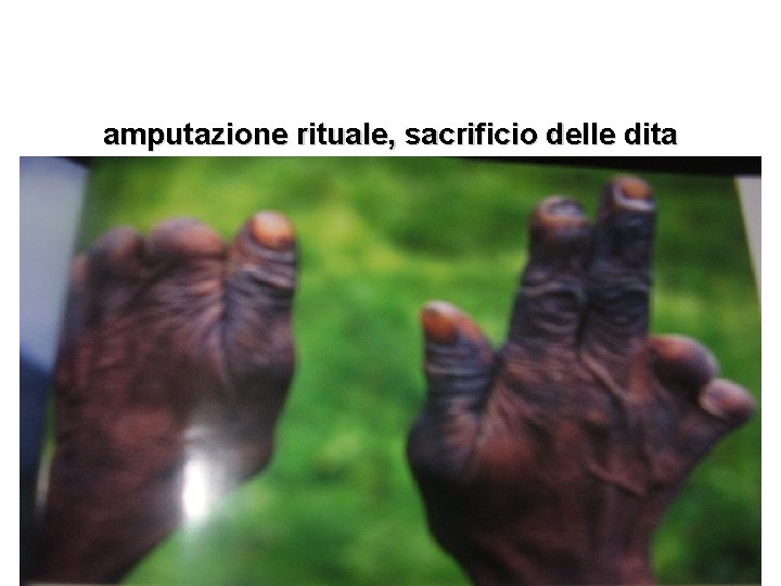 amputazione rituale, sacrificio delle dita 