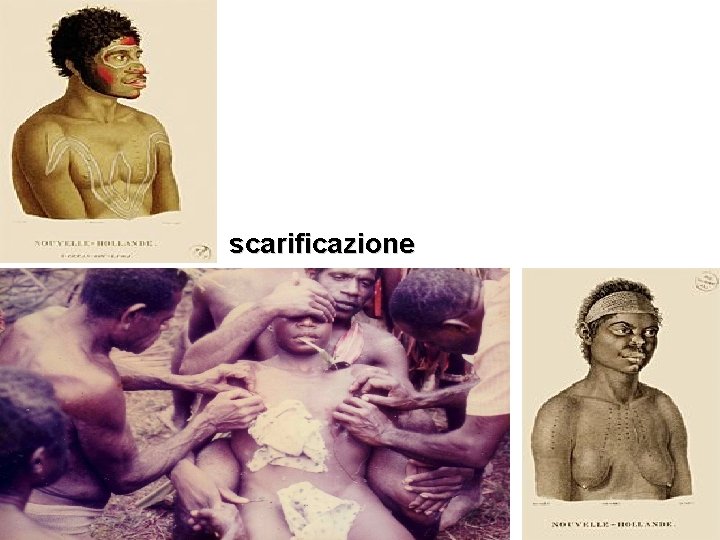 scarificazione 