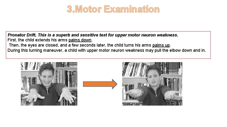 3. Motor Examination Pronator Drift. This is a superb and sensitive test for upper