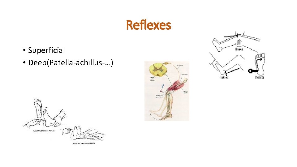 Reflexes • Superficial • Deep(Patella-achillus-…) 