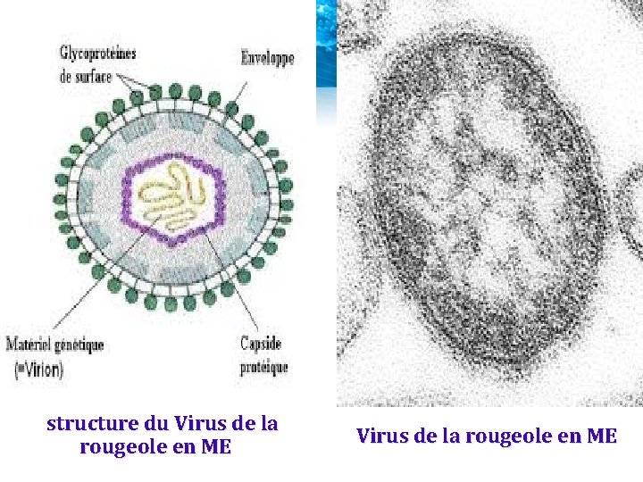 structure du Virus de la rougeole en ME structure du Virus de la rougeole en ME