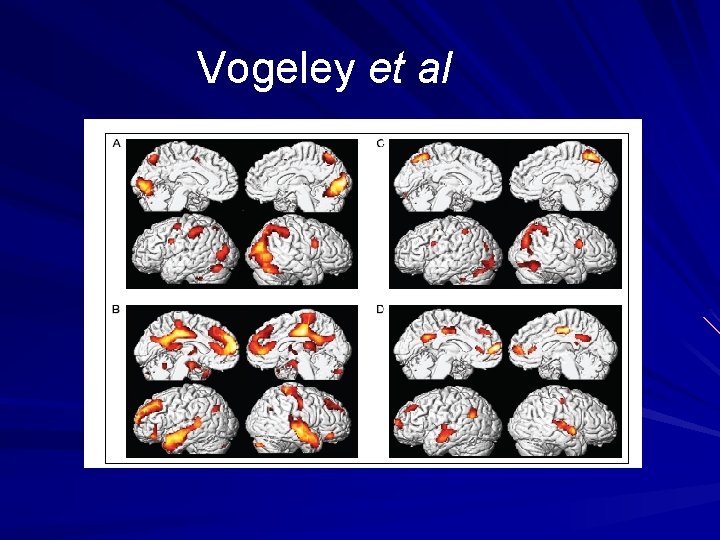 Vogeley et al 