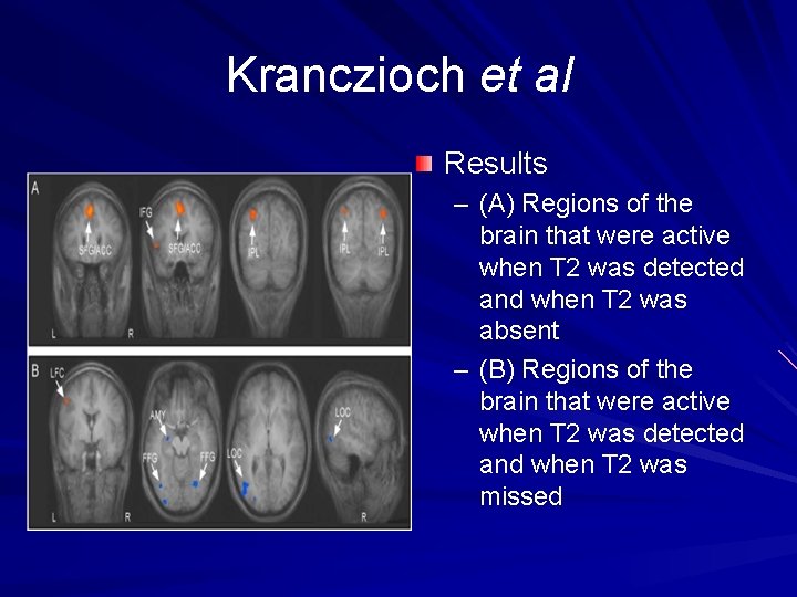 Kranczioch et al Results – (A) Regions of the brain that were active when